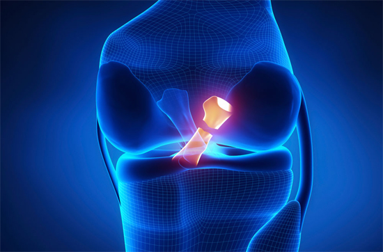 PCL Injury Treatment in India