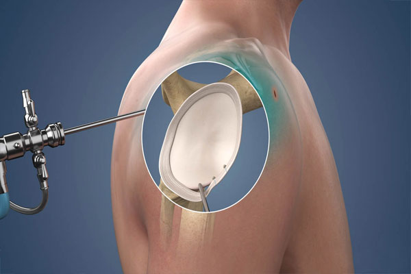 knee sports injury treatment in rajasthan