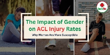 The Impact of Gender on ACL Injury Rates: Why Women Are More Susceptible