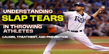 Understanding SLAP Tears in Throwing Athletes Causes, Treatment, and Prevention.