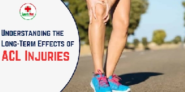 Understanding the Long-Term Effects of ACL Injuries