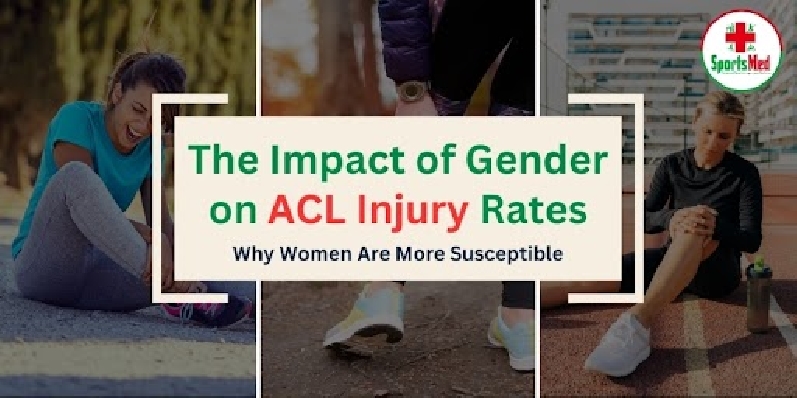 The Impact of Gender on ACL Injury Rates: Why Women Are More Susceptible