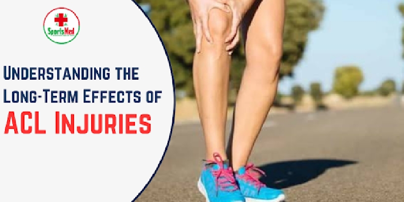 Understanding the Long-Term Effects of ACL Injuries